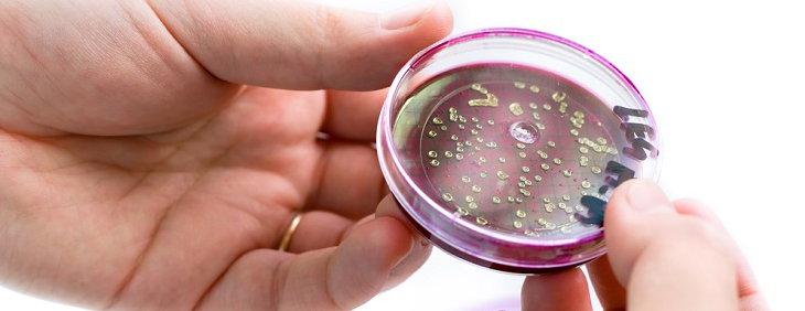 e coli